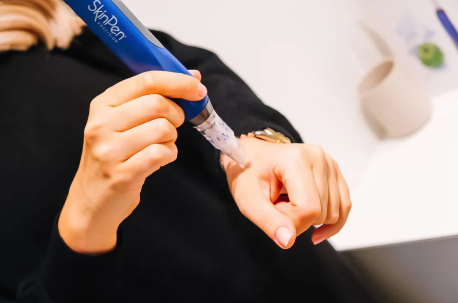 Skinpen behandeling Zhenzhu