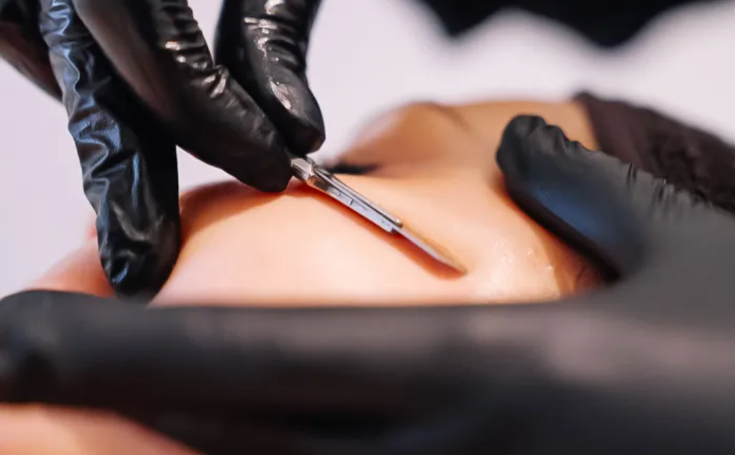 Dermaplaning behandeling Zhenzhu Skin Clinic